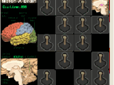 Match-A-Brain